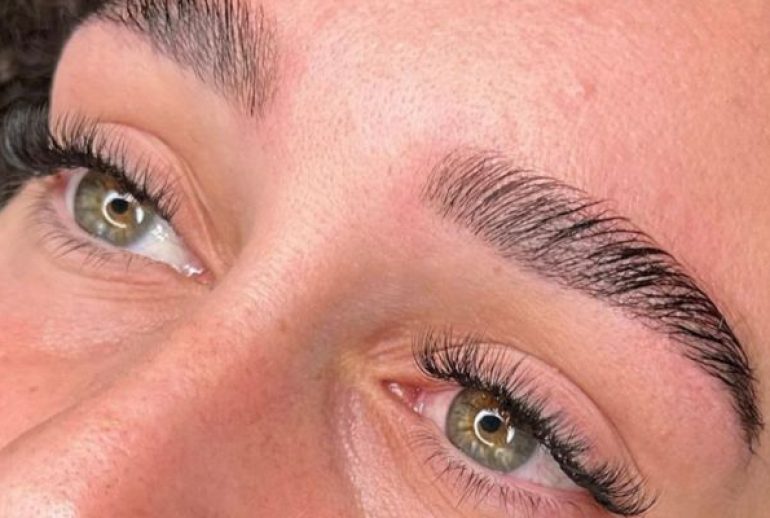 Browlift